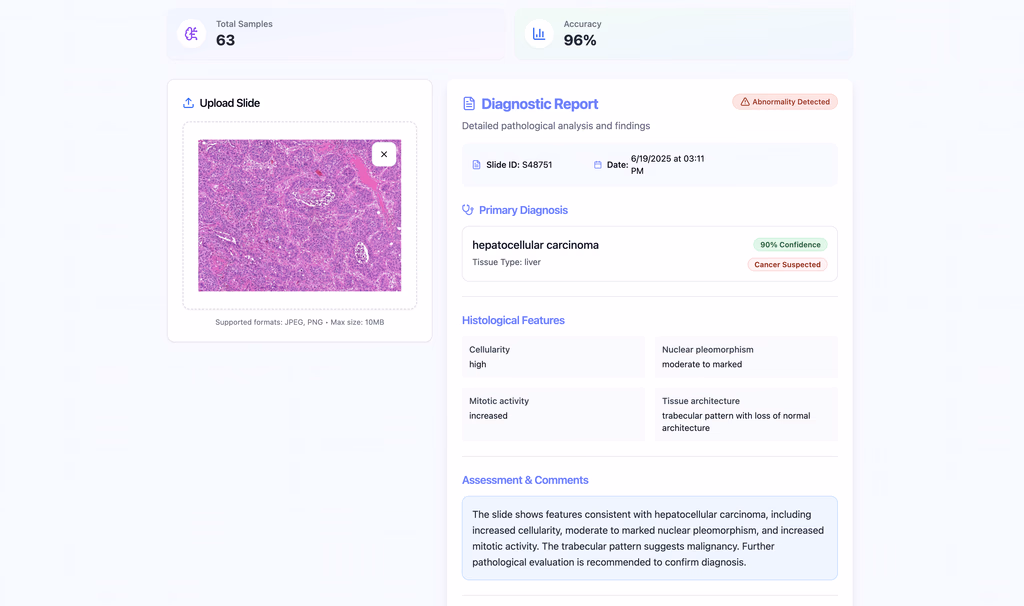 AI Powered Pathology – Slide-Based Cancer Diagnosis